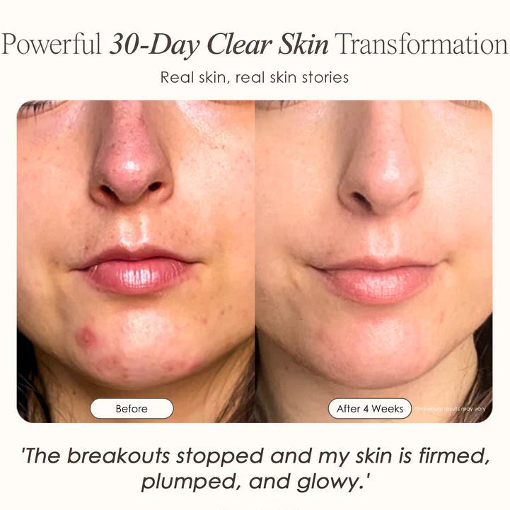 ELYX | Collagen Wand